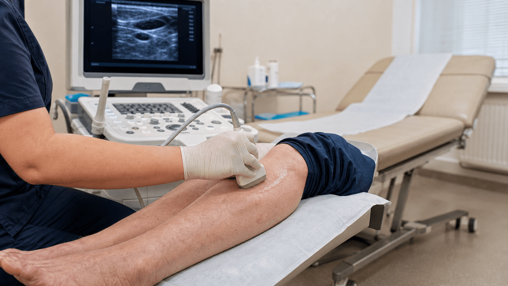 Тромбофлебит: почему варикоз нельзя оставлять без внимания