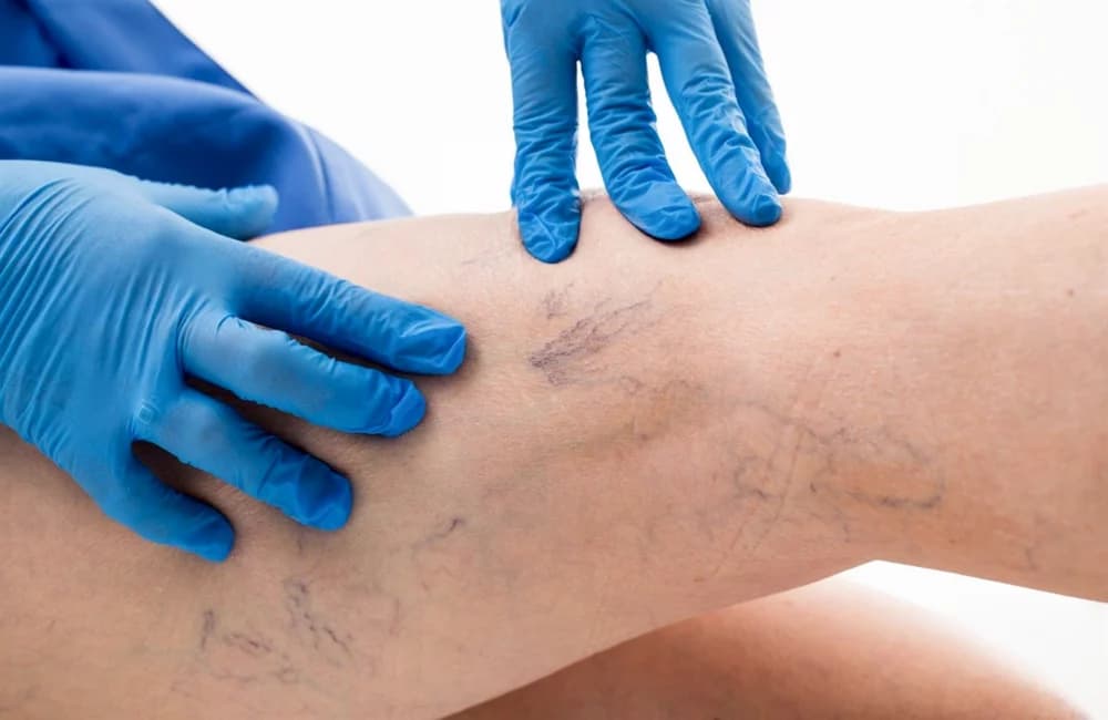 Avenia Clinic в Алматы — клиника флебологии, лазерное лечение варикоза и УЗИ вен