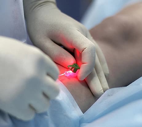 Современное лазерное лечение варикоза в Avenia Clinic, Алматы